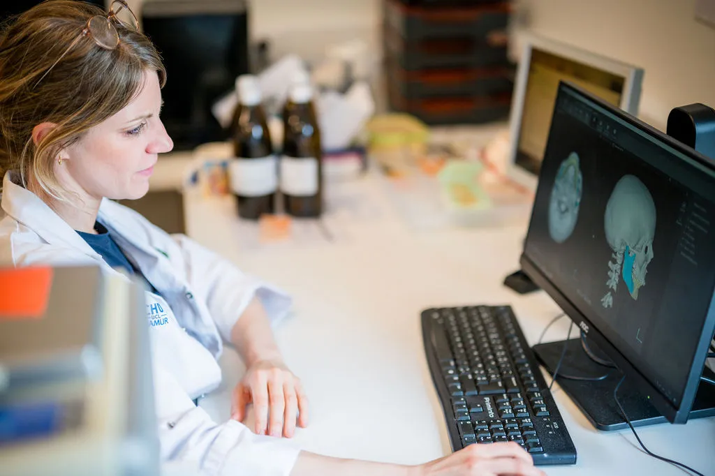 simulation et traitement 3D - chirurgie orthognathique
